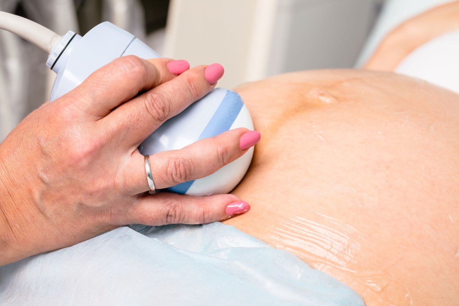Pregnant woman undergoing an ultrasound