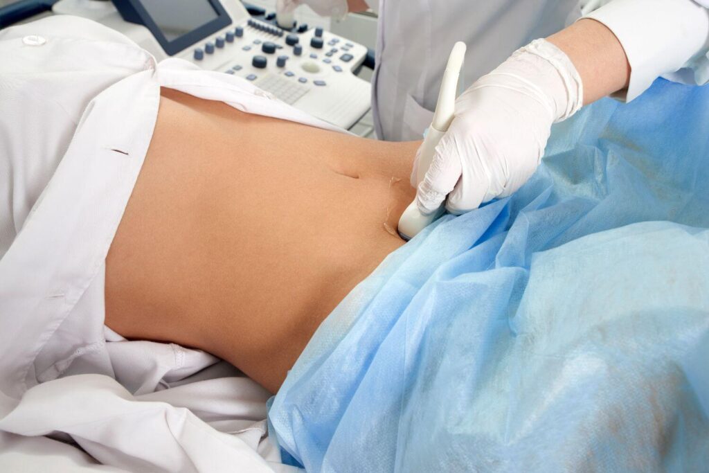 A woman receiving an ultrasound during early stages of pregnancy
